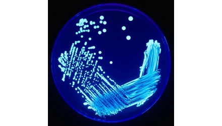 Vízhálózatok, intézmények Legionella mentesítése